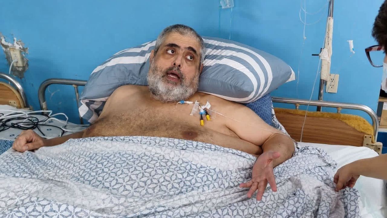 Muere Nasser Hilsaca, conocido por su lucha contra la obesidad extrema en Honduras
