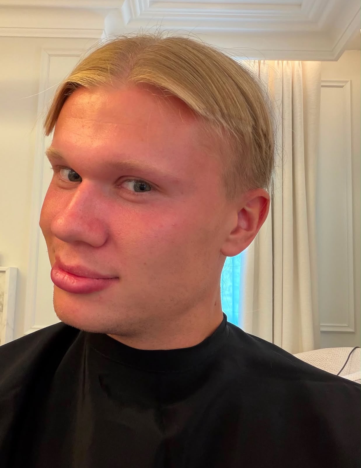 El delantero noruego estrenó su nuevo look durante el debut del Manchester City ante Bournemouth en la Premier League.