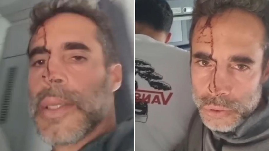 El piloto fue atacado por un pasajero que ingresó a la cabina con un cuchillo en mano.